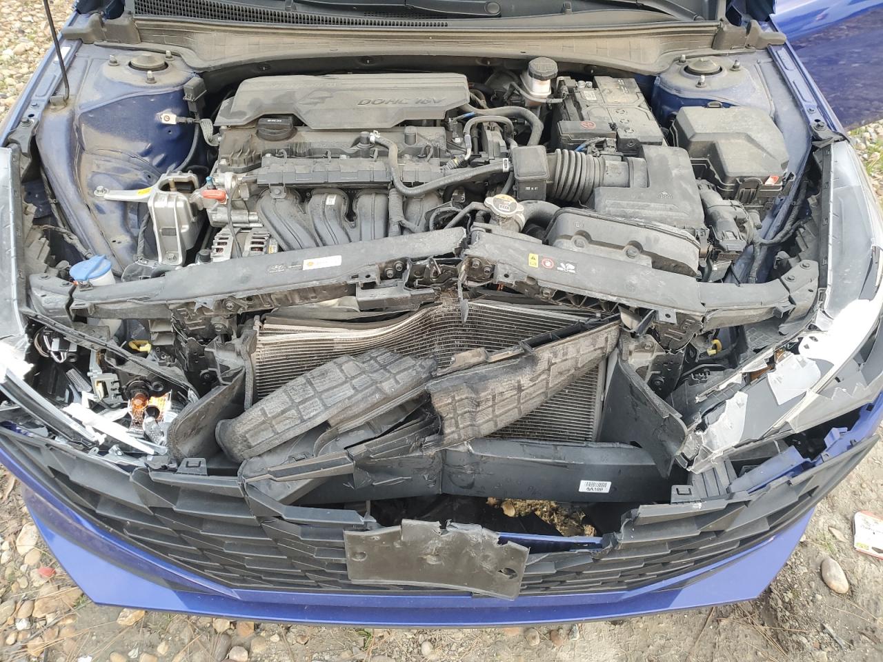 Hyundai ELANTRA Se Image 6